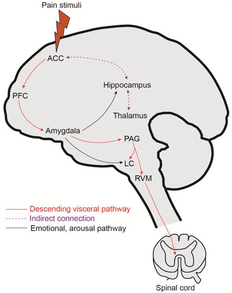 Visceral Pain Causes Symptoms And Management Strategies