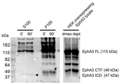 Peer Review In Presenilin Secretase Dependent Epha Processing