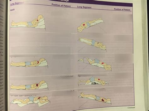 Postural Drainage Diagram Quizlet