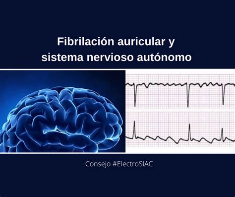 Fibrilaci N Auricular Y Sistema Nervioso Aut Nomo