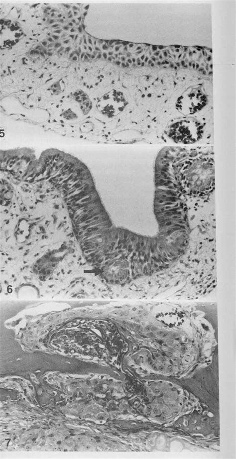 Figure 5 From Morphology Of Nasal Lesions Induced In Osborne Mendel Rats And B6c3f1 Mice By