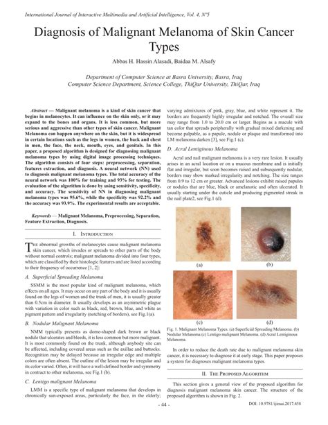 Figure 10 From Classification Of Melanoma Skin Cancer Using Images