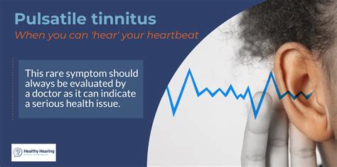 Pulsatile Tinnitus When You Can Hear Your Pulse