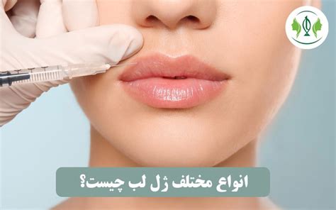 تزریق انواع ژل لب در کرج چگونه ژل لب مناسب را انتخاب کنیم ؟ کلینیک