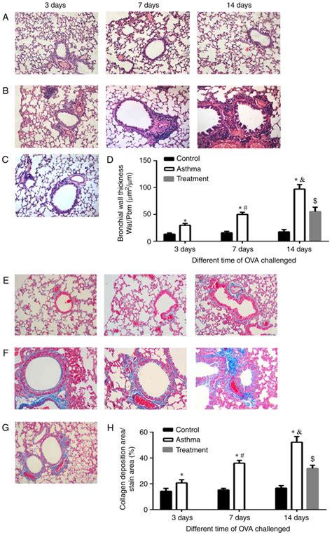 Ormdl May Participate In The Pathogenesis Of Bronchial Epithelial