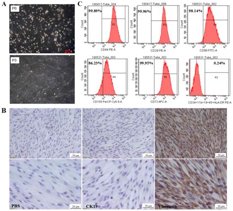 Effect Of Cd44 On Differentiation Of Human Amniotic Mesenchymal Stem