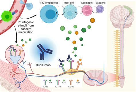 Dupilumab For Cancer Associated Refractory Pruritus Journal Of