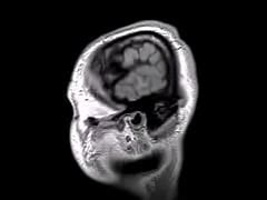 Structural Mri Animation Free Mobile Porn Videos IPornTV
