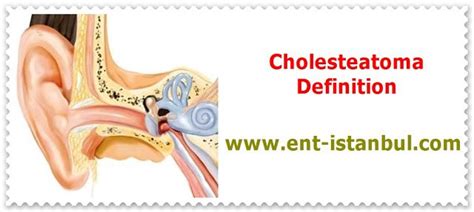 Cholesteatoma Definition Nasal Obstruction Basal Cell Carcinoma