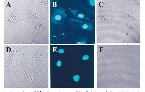 Figure 3 from Detection and treatment of mycoplasma contamination in