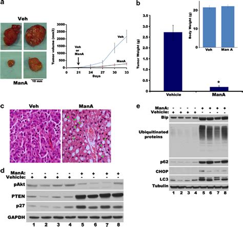 Man A Inhibits Human Breast Tumor Growth In Nude Mice A Relative