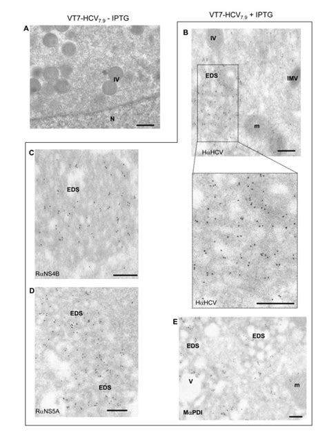 Immunogold Electron Microscopy Analysis Of The Localization Of Hcv