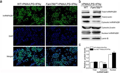 Fam76b Regulates Nf κb Mediated Inflammatory Pathway By Influencing The