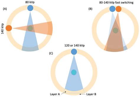 J Imaging Free Full Text Dual Energy Ct Of The Heart A Review