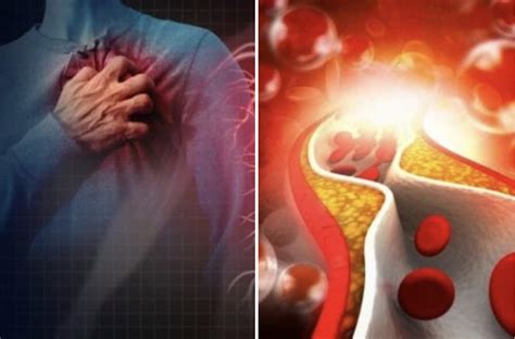 Che Colpo Al Cuore In Italia Le Malattie Cardiovascolari Sono Ancora