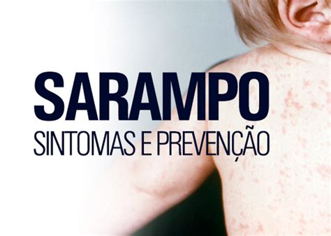 Sarampo Sintomas Preven O Causas Complica Es E Tratamento