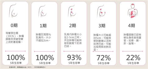 乳腺癌该如何分类？ 知乎