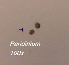 Peridinium Under Microscope