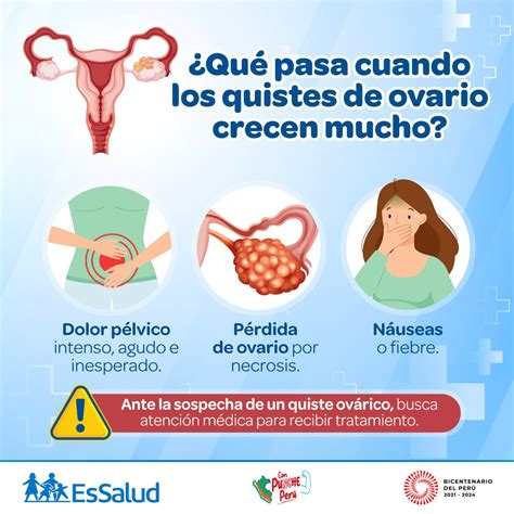 EsSalud Perú on Twitter Atención Ante la sospecha de un quiste