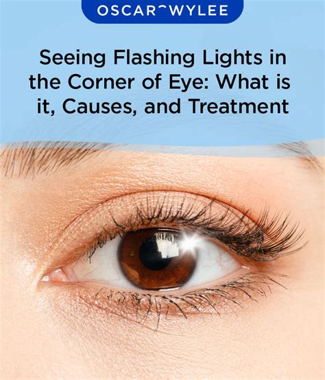 Seeing Flashing Lights In The Corner Of Eye What Is It Causes And Treatment