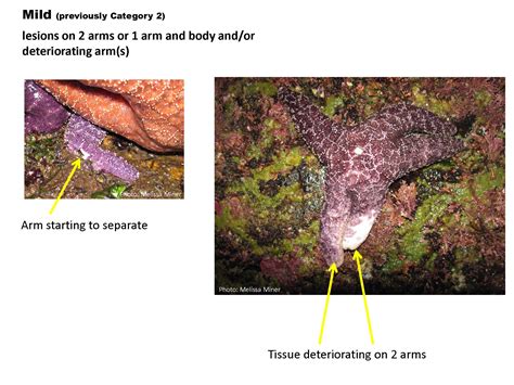 Sea Star Wasting Syndrome MARINe