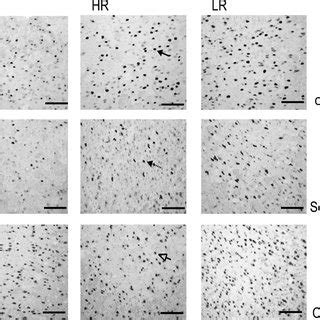 Photomicrographs Showing Representative Expression Of C Fos CRF And