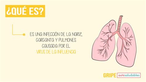 La Gripe Causas Síntomas Y Tratamiento Enfermedades La Gripe Es Una Infección De La Nariz