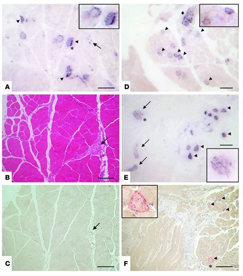 Jci Preclinical Deposition Of Pathological Prion Protein Prpsc In