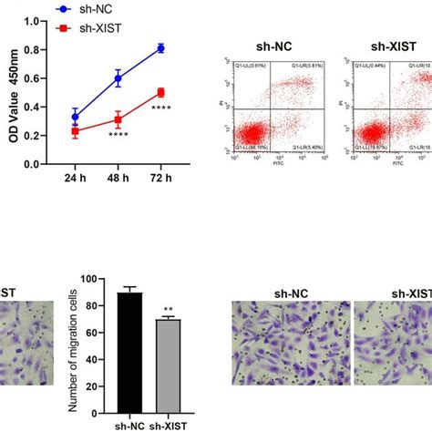 Silencing Of Xist Inhibits Proliferation Migration And Invasion And