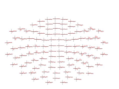 Overview Of Meg Eeg Analysis With Mne Python Mne Documentation