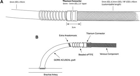 Safety And Efficacy Of A Modified Hero Dialysis Device In Achieving