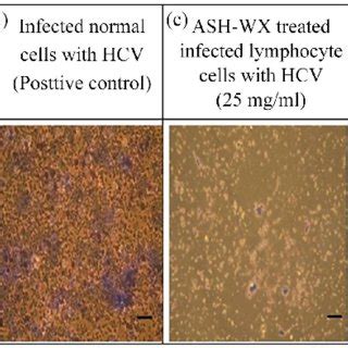 Effect Of Ash Wx At Concentration Mg Ml And Mg Ml On Colony