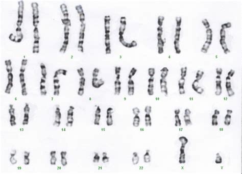 Where Did The Y Chromosome Come From Asian Scientist Magazine