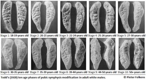 Age Estimation From Morphological Changes In Pubic Symphysis IJFCM