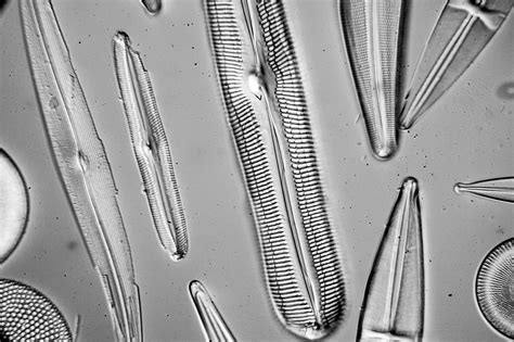 DIC images – Experiences in optical and electron microscopy