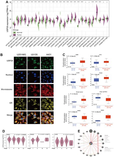 Comprehensive Prognostic And Immunological Analysis Of Ubiquitin