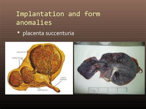 Placenta And Amniotic Fluid