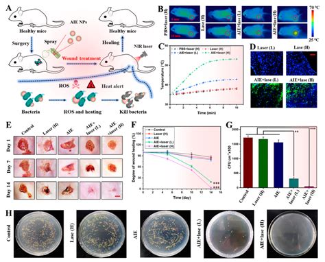 南京师范大学张明 港中深唐本忠院士等ACS NanoAIE 纳米颗粒实现单次近红外光触发光动力和光热抗菌治疗 腾讯新闻