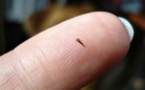 Handy: how to remove a splinter on your own