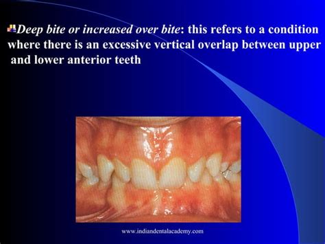 Malocclusion Classification Certified Fixed Orthodontic Courses By