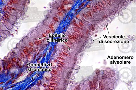 Uomo Giovane Prostata Sezione Trasversale X Uomo Mammiferi