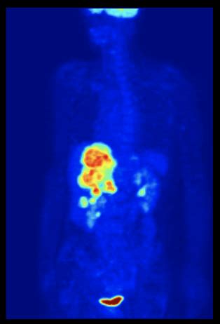 RAD 100 Radiography And Nuclear Medicine Flashcards Quizlet