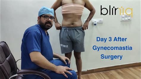 Patient Review On Day 3 After Gynecomastia Surgery Youtube