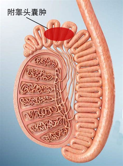 慢性附睾炎的治疗原则是什么？ 哔哩哔哩