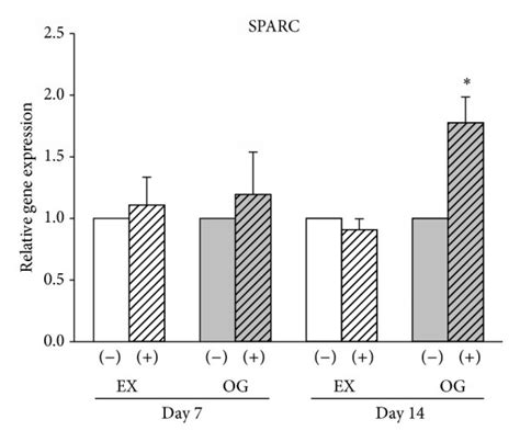 Regulation Of Osteogenesis Specific Markers Under The Influence Of