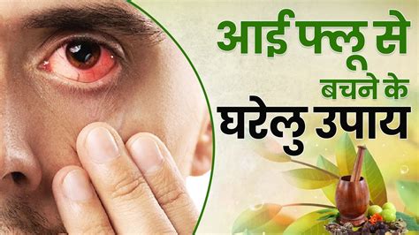 Eye Flu Home Remedies To Reduce Conjunctivitis Symptoms Latest News