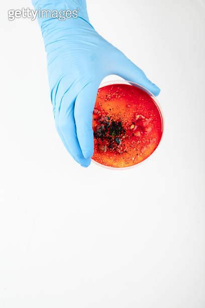 Hand In Blue Glove Holding Petri Dish With Bacterium Microbiology