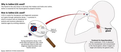 Why And How Is Iodine 131 Used Graphics