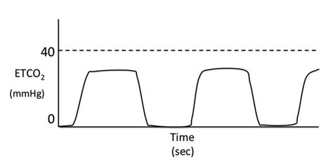 Understanding Capnography Vet Times