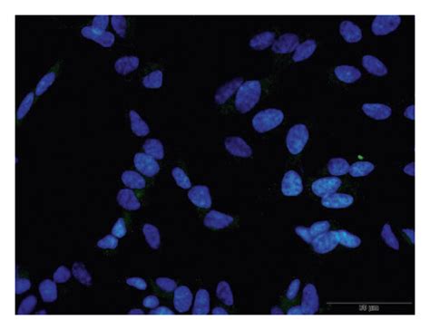 Differentiation of SH-SY5Y cells into a neuronal phenotype. SH-SY5Y ...